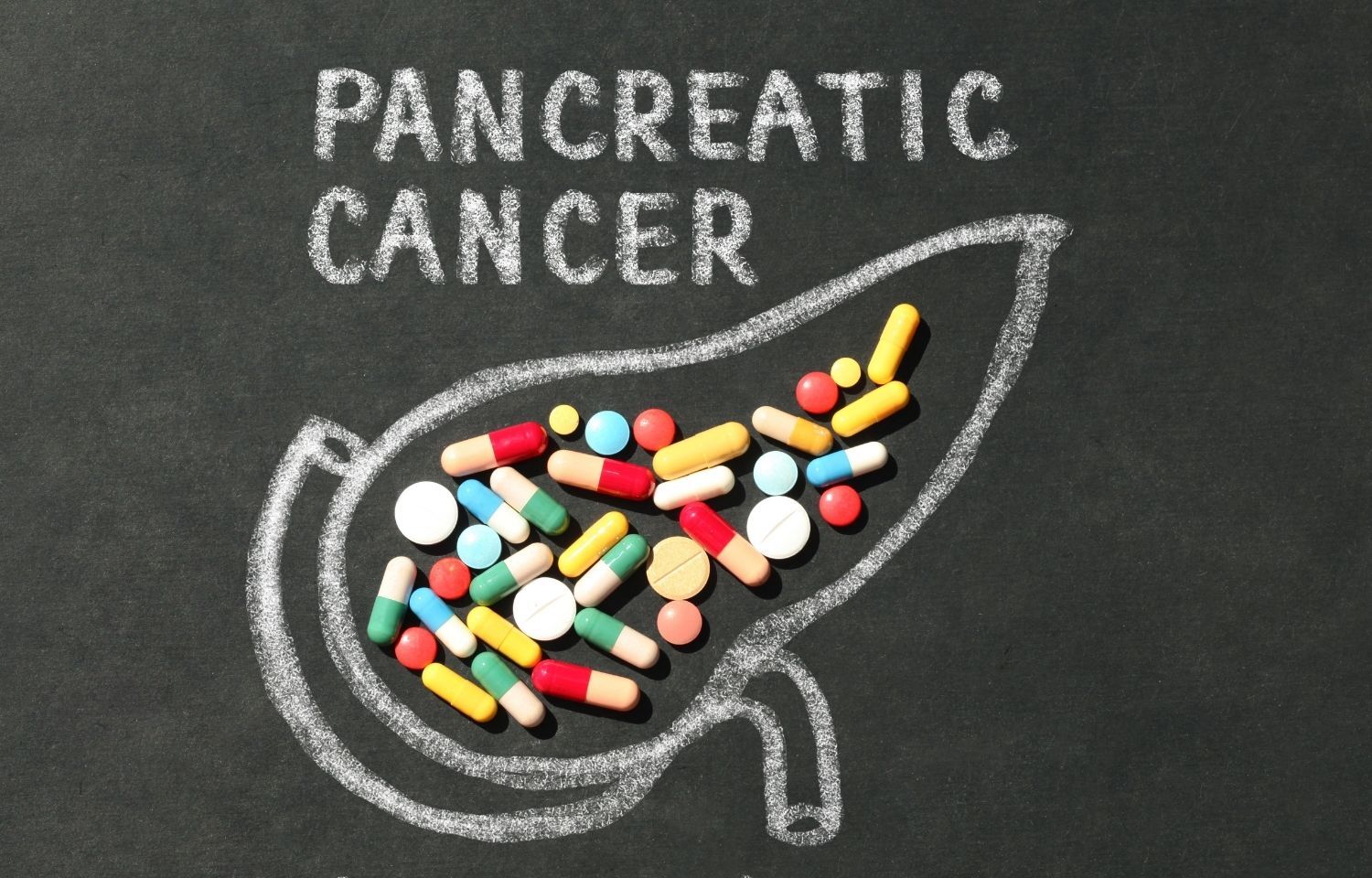 Ketogenic diet could improve response to pancreatic cancer therapy, reveals research